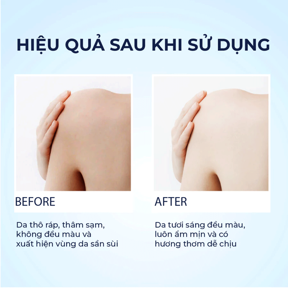 bbx/common/7cc72df9-8fb6-4cfe-82a3-98dc0614f49f.webp bbx/common/7cc72df9-8fb6-4cfe-82a3-98dc0614f49f.webp